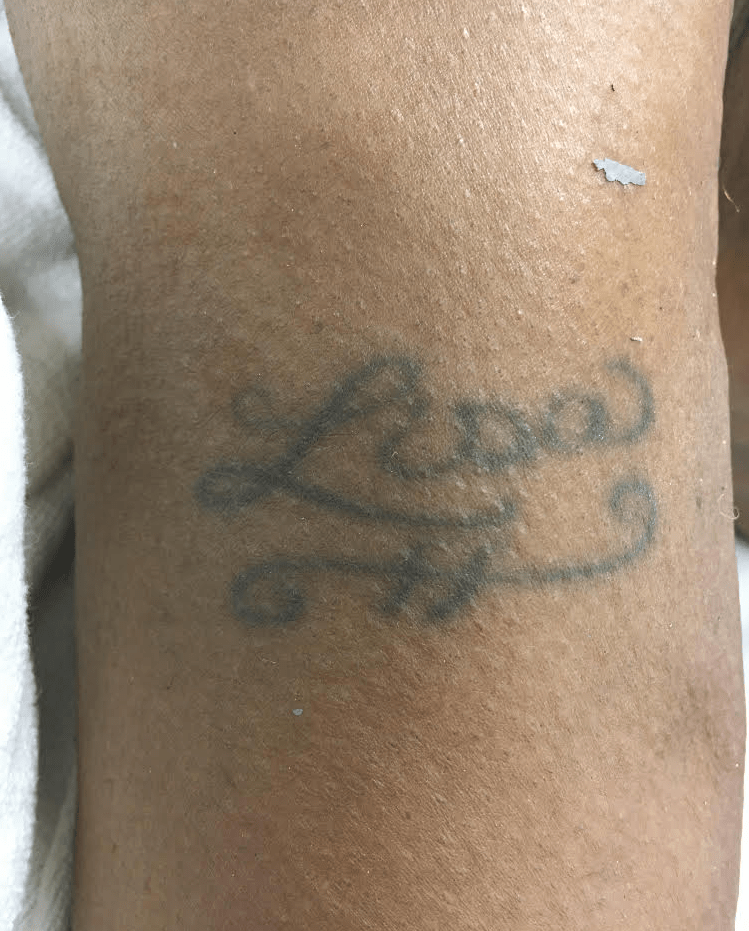 The deceased has the name “Lisa” tattooed on the upper part of her right arm. 