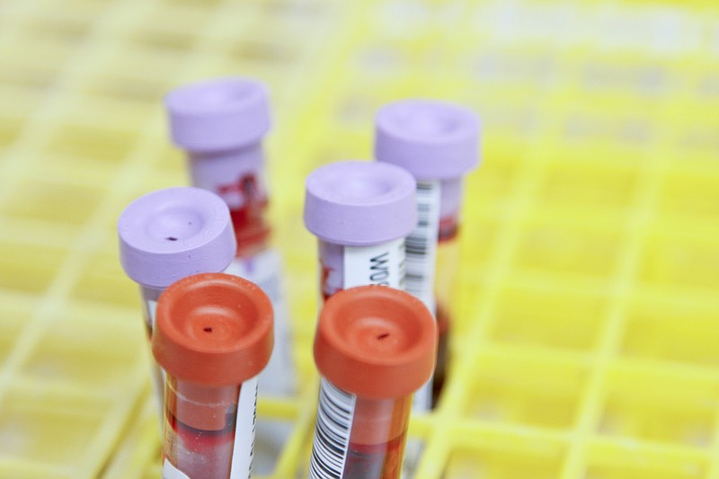 Police obtained blood samples thanks to a search warrant in the case. (Credit: National Cancer Institute / Unsplash.com)