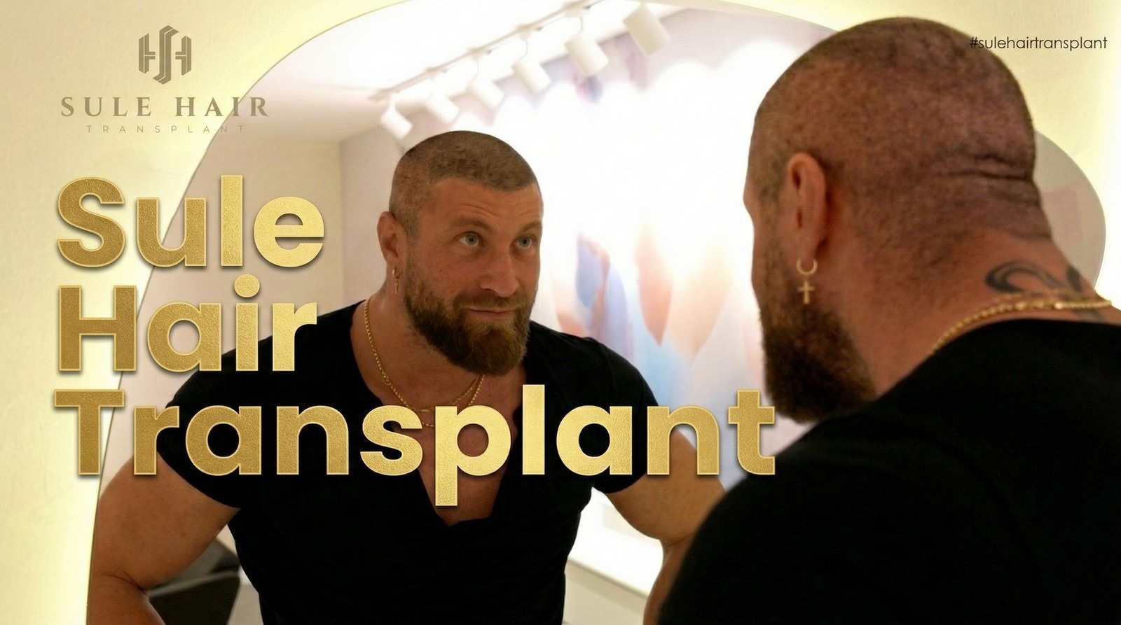 Sule Hair Transplant