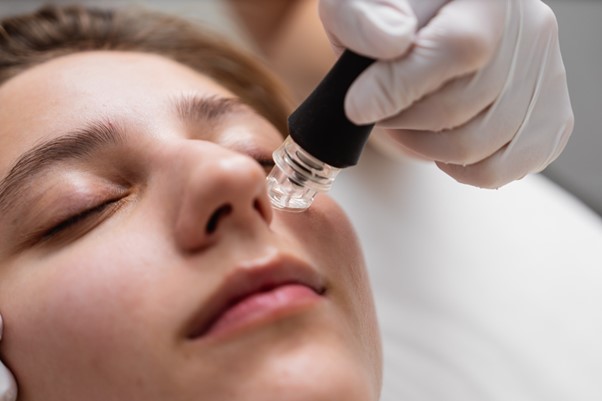 What Are the Benefits of Microneedling Treatments?